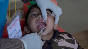 Child tooth extraction